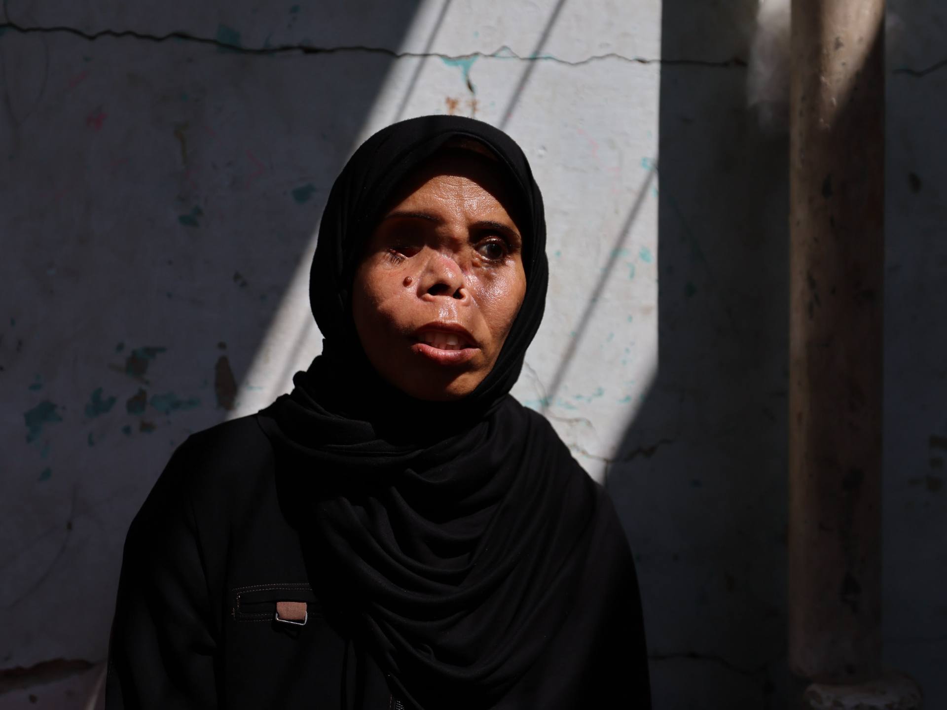 Read more about the article In Gaza, a long path to recovery for one woman who lost eye, and daughter