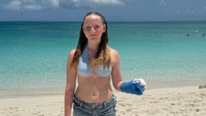 Read more about the article Barracuda attacks Texas teen, badly injures her hand in Turks and Caicos vacation spot