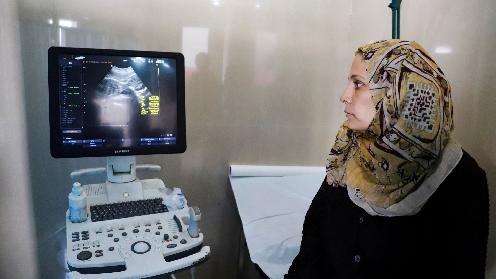 You are currently viewing ‘The dream I carried is gone’: Miscarriages rise amid trauma of Gaza’s war