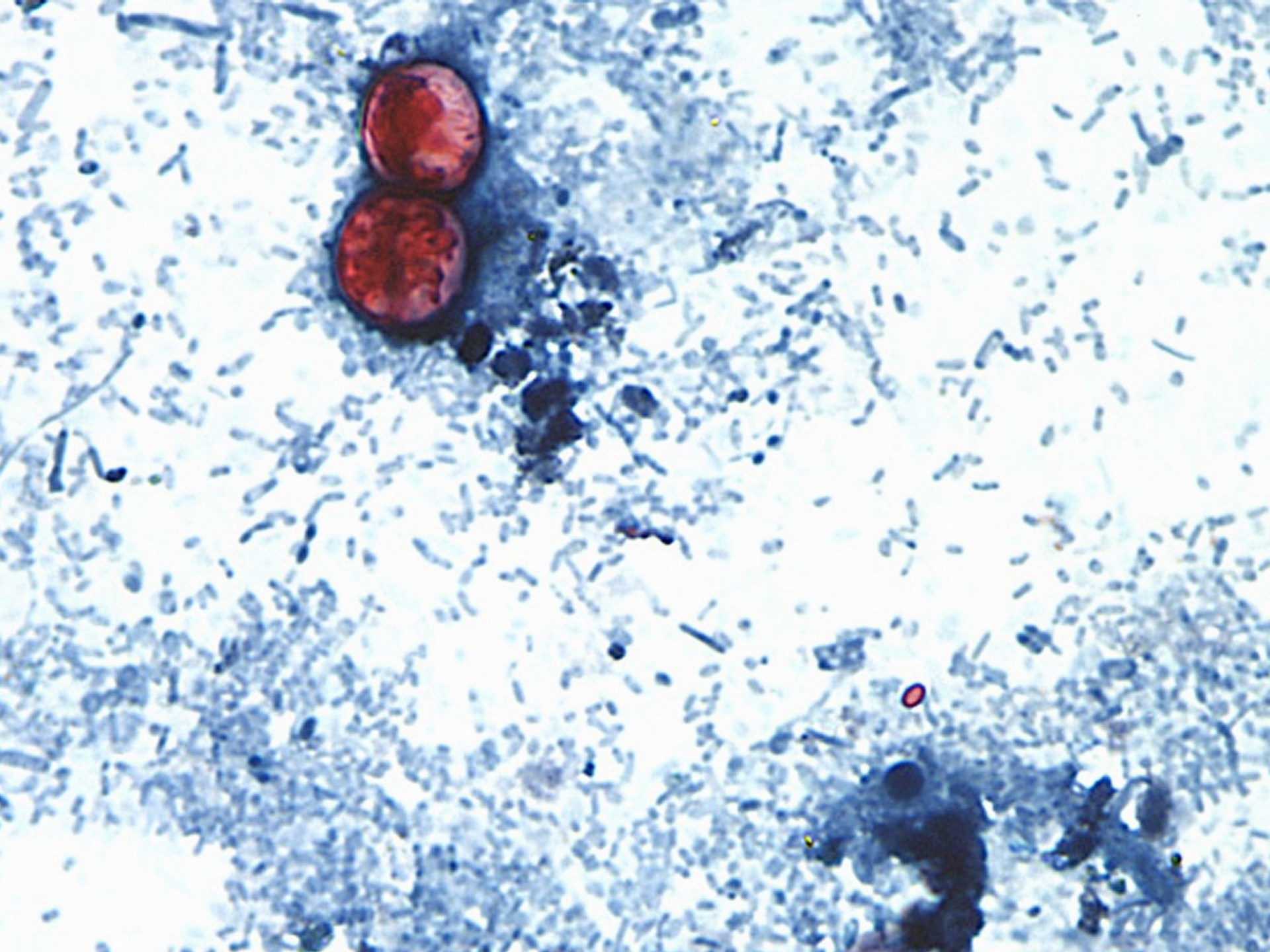 You are currently viewing US announces first two deaths from cyclospora outbreak