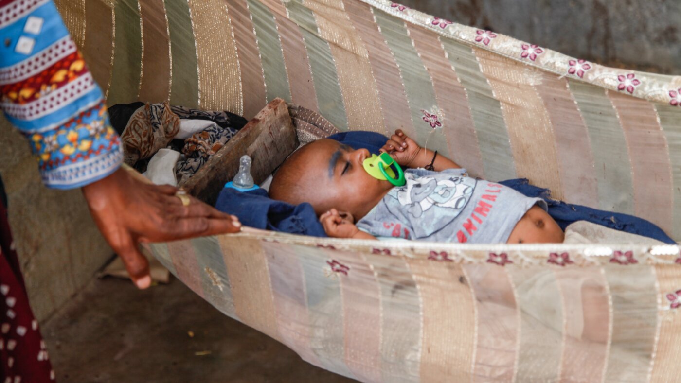 You are currently viewing Why’s the rate of premature birth so high in this community? : NPR